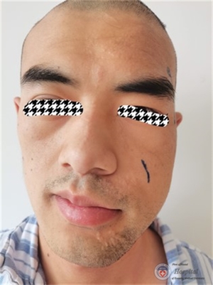 41