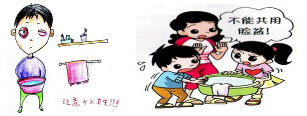 红眼病8