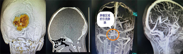 窦汇
