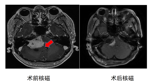 神经外二