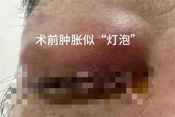 灯泡眼1