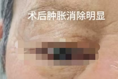 灯泡眼2